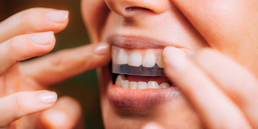 Tested: The best, most effective teeth whitening strips