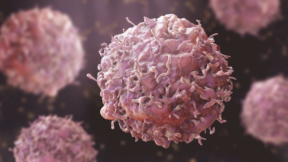 Cancer: Facts about the diseases that cause out-of-control cell growth