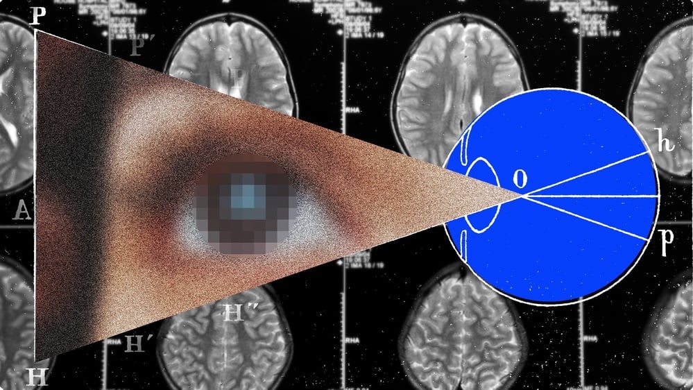 The Next Frontier for Brain Implants Is Artificial Vision