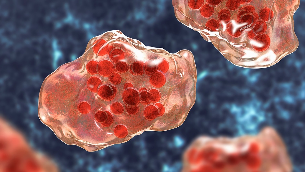 2 school-age children have died in Texas measles outbreak, as total cases pass 480