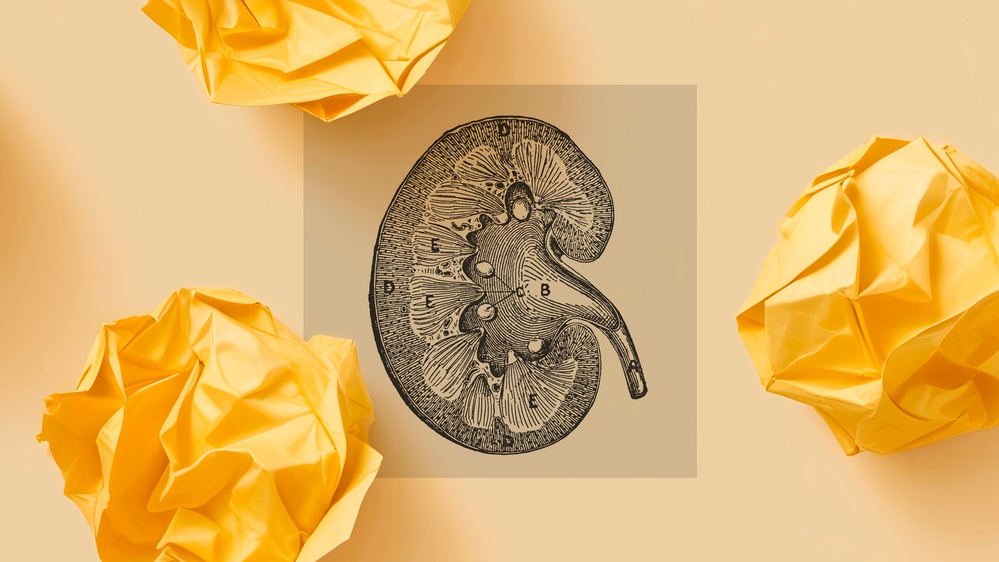 Would You Give Up Your Kidney for $50,000?