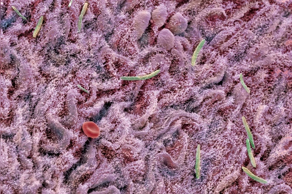 Gut microbiome manipulation holds potential for health improvements
