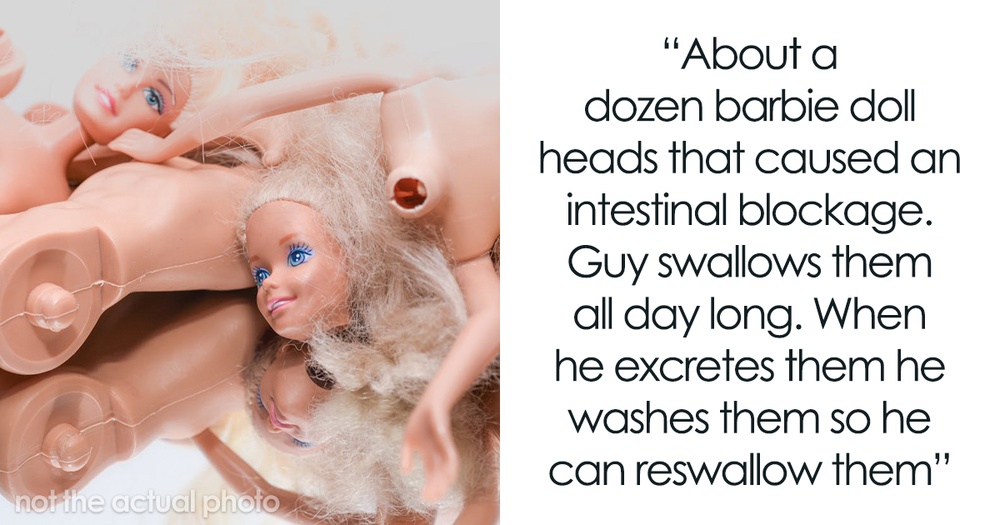 55 Of The Weirdest Things Doctors Had To Remove From Someone's Body