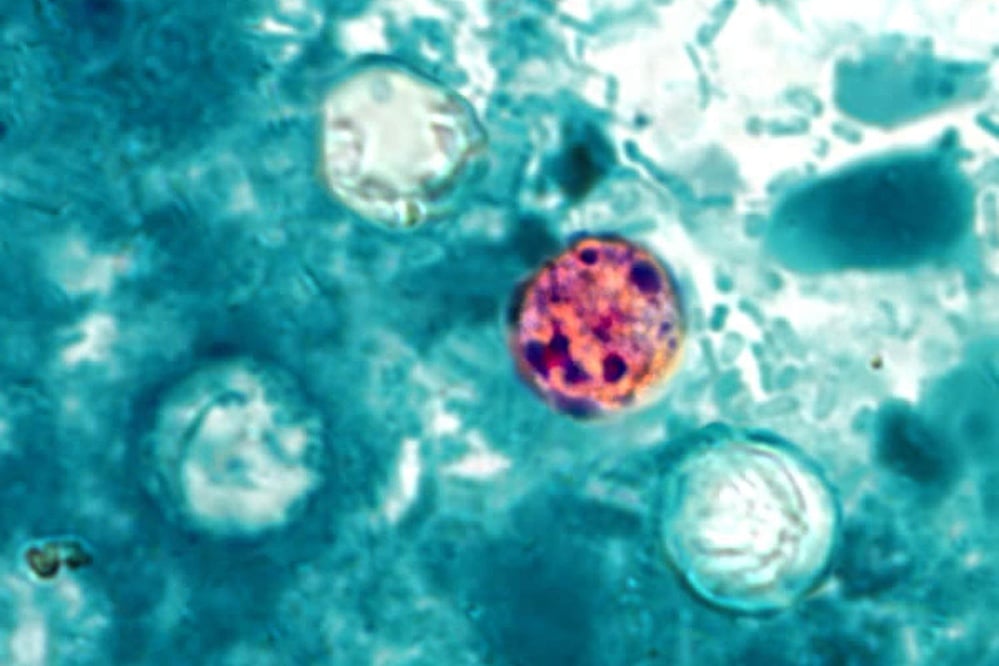 CDC reports nearly 7,000 cyclosporiasis cases confirmed or under investigation