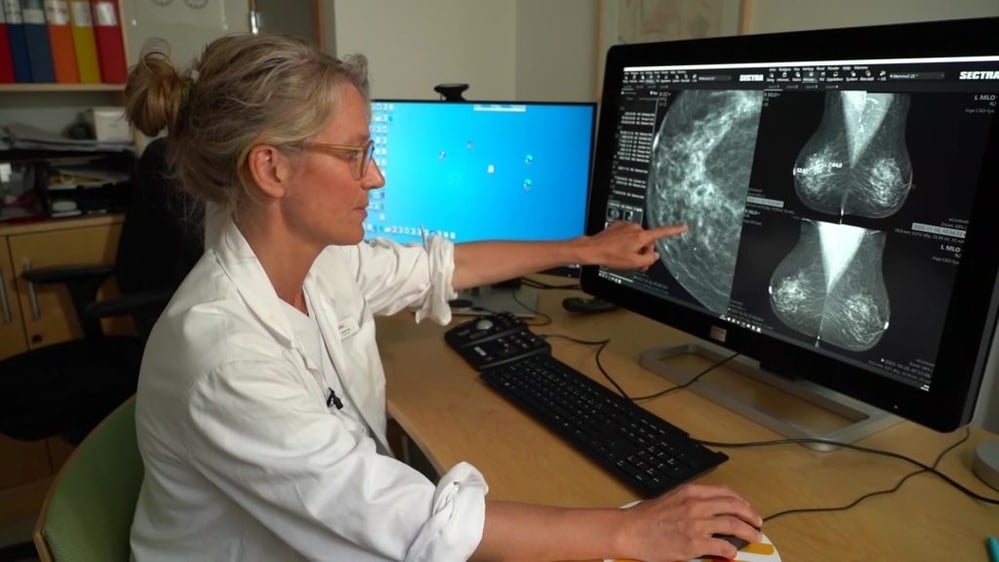 New FDA rules aim to enhance breast cancer detection.