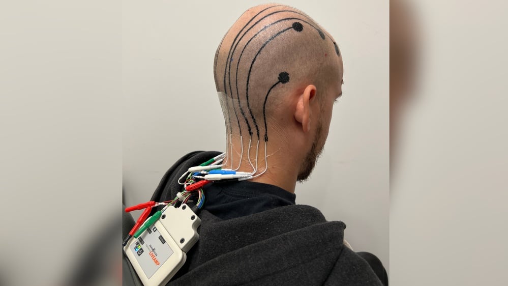 Innovative e-tattoo technology revolutionizes brain monitoring methods