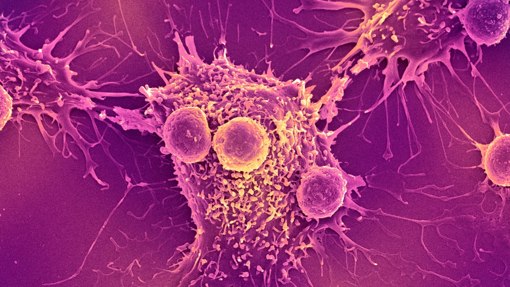 Emerging cancer treatments include plant compounds, mRNA vaccines, and trial efficiency.