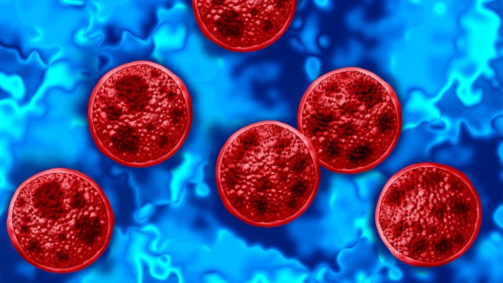 Michigan reports the first two deaths linked to the multistate cyclosporiasis outbreak, amid more than 18,000 suspected or confirmed cases