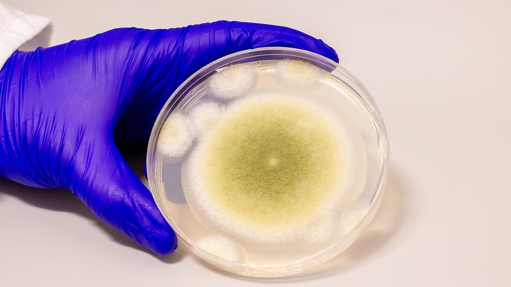Molecules from Aspergillus flavus show promise against leukemia cells.