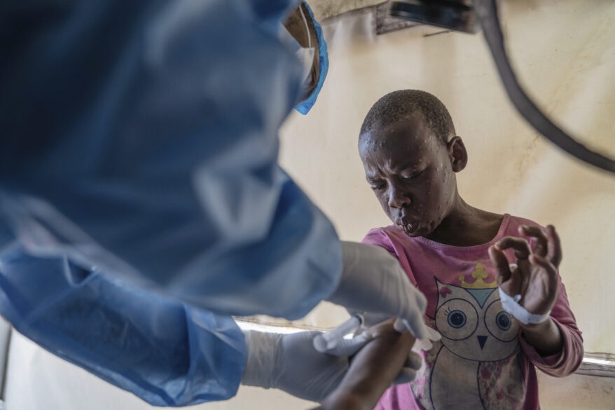 Mpox Offers Another Chance to Confront Vaccine Inequity