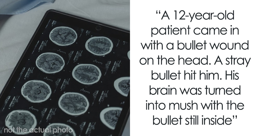 18 Doctors Share The Weirdest And Most Disgusting Things Found In People's Bodies
