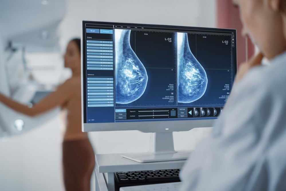 Advanced screening methods triple detection in dense breast tissue.