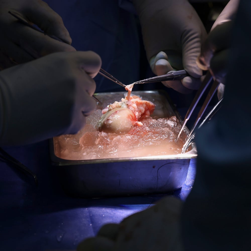Pig kidney transplant patient discharged